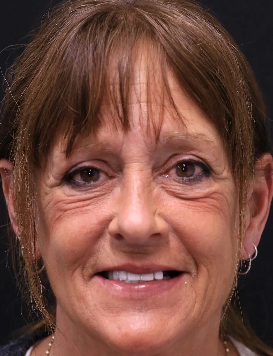 Full-arch restoration by Dr. Hogan — before treatment